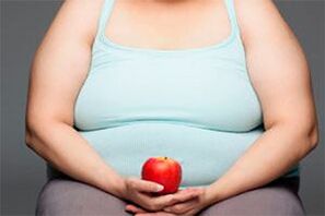 Če želite pozdraviti krčne žile, morate izgubiti odvečno težo